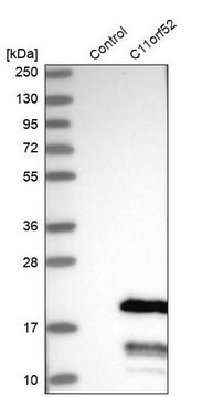 Anti-C11orf52 antibody produced in rabbit Prestige Antibodies&#174; Powered by Atlas Antibodies, affinity isolated antibody, buffered aqueous glycerol solution