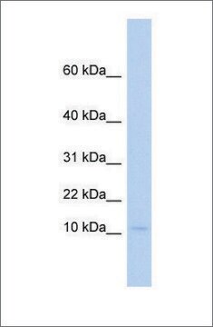 Anti-PLAC9 antibody produced in rabbit affinity isolated antibody