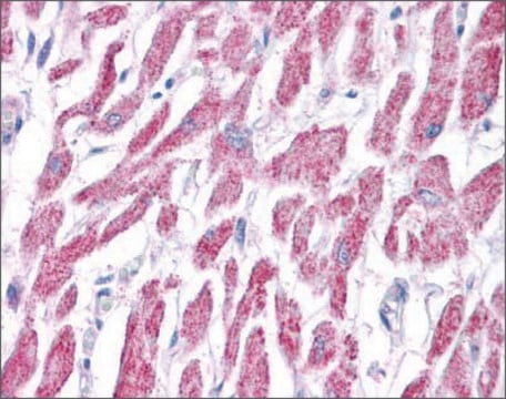 抗ACAT1抗体 ウサギ宿主抗体 affinity isolated antibody