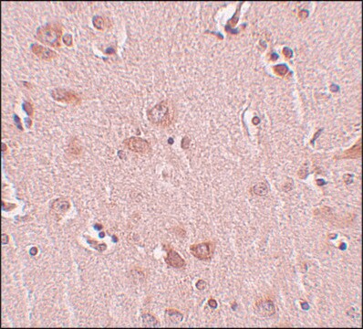 Anti-PLEKHM2 antibody produced in rabbit affinity isolated antibody, buffered aqueous solution