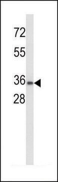 ANTI-UPK1A (C-TERM) antibody produced in rabbit IgG fraction of antiserum, buffered aqueous solution