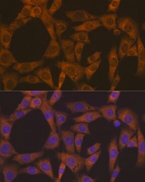 Anti-CAD Antibody, clone 0O8D6, Rabbit Monoclonal