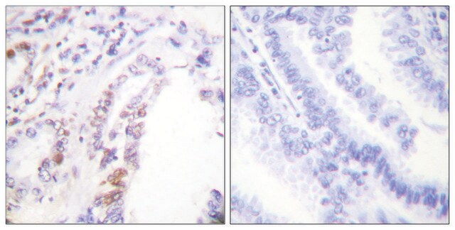 Anti-AML1 antibody produced in rabbit affinity isolated antibody