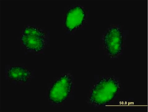 Anti-ETV7 antibody produced in mouse purified immunoglobulin, buffered aqueous solution