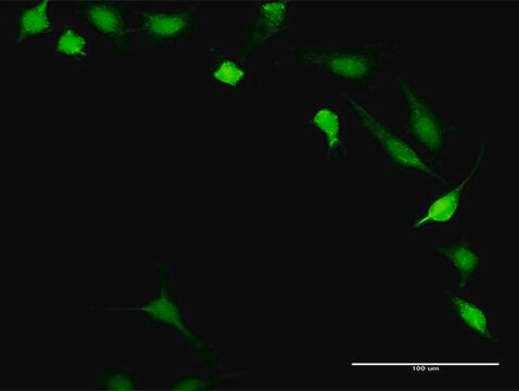 Anti-PPP3R1 antibody produced in rabbit purified immunoglobulin, buffered aqueous solution