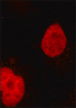 Anti-otub1 Antibody, Mouse Monoclonal Clone Otu14, Purified From 