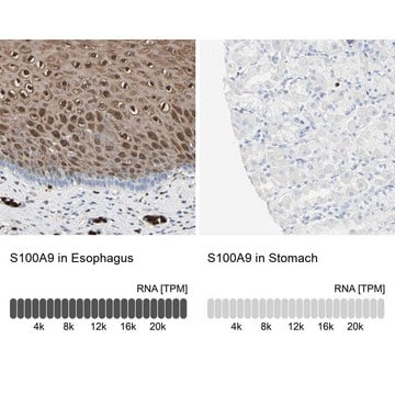 Anti-S100A9 antibody produced in rabbit Prestige Antibodies&#174; Powered by Atlas Antibodies, affinity isolated antibody, buffered aqueous glycerol solution