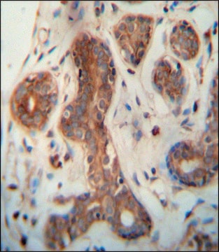 ANTI-CEPT1 (N-TERM) antibody produced in rabbit IgG fraction of antiserum, buffered aqueous solution