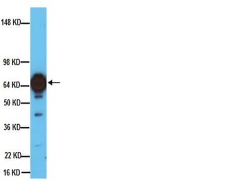 Anticuerpo anti- tirosina hidroxilasa, clon 2/40/15 clone 2/40/15, Chemicon&#174;, from mouse