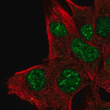 Anti-PLA1A antibody produced in rabbit Prestige Antibodies&#174; Powered by Atlas Antibodies, affinity isolated antibody