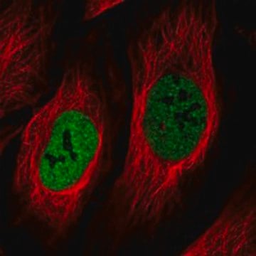 Anti-Nek5 Antibody Produced In Rabbit Prestige Antibodies&#174; Powered by Atlas Antibodies, affinity isolated antibody, buffered aqueous glycerol solution