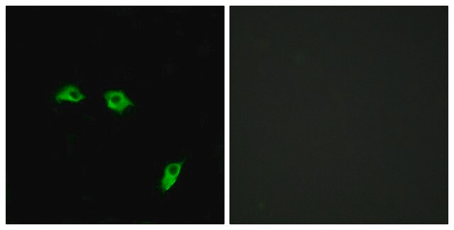 Anti-GABBR1 antibody produced in rabbit affinity isolated antibody