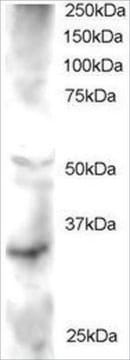 Anti-FRAT2/GSK-3 antibody produced in goat affinity isolated antibody, buffered aqueous solution