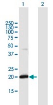 Anti-IFNA21 antibody produced in mouse purified immunoglobulin, buffered aqueous solution