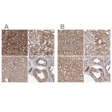 Anti-TRAIP antibody produced in rabbit Prestige Antibodies&#174; Powered by Atlas Antibodies, affinity isolated antibody, buffered aqueous glycerol solution