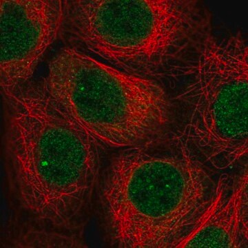 Anti-TNFAIP8 antibody produced in rabbit Prestige Antibodies&#174; Powered by Atlas Antibodies, affinity isolated antibody