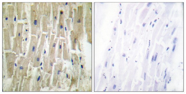 Anti-PDLIM1 antibody produced in rabbit affinity isolated antibody