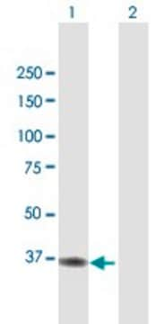 Anti-ACAD8 antibody produced in mouse purified immunoglobulin, buffered aqueous solution