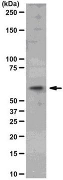 Anti-Akt2/PKB&#946; Antibody, clone AW114, rabbit monoclonal clone AW114, from rabbit