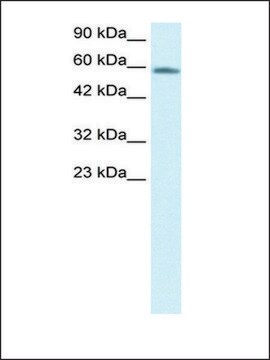 Anti-CHES1 antibody produced in rabbit IgG fraction of antiserum