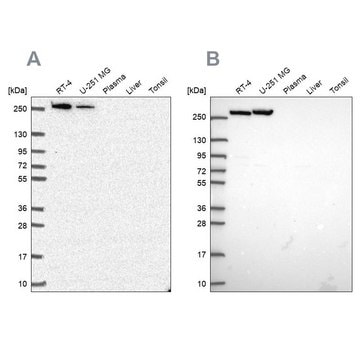 Anti-CAD antibody produced in rabbit Prestige Antibodies&#174; Powered by Atlas Antibodies, affinity isolated antibody