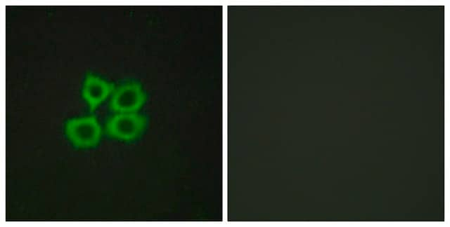 Anti-CRHR2 antibody produced in rabbit affinity isolated antibody