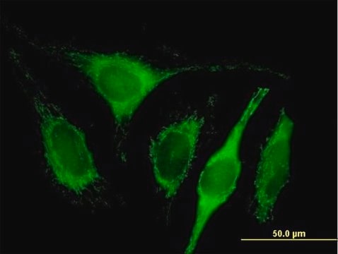 Anti-C1QBP antibody produced in mouse purified immunoglobulin, buffered aqueous solution