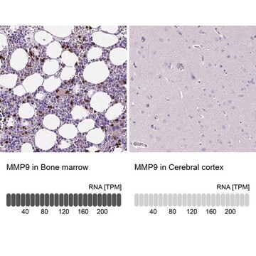 Anti-MMP9 antibody produced in rabbit Prestige Antibodies&#174; Powered by Atlas Antibodies, affinity isolated antibody, buffered aqueous glycerol solution