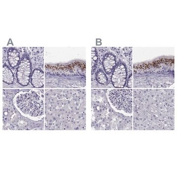 Anti-RNASE12 Prestige Antibodies&#174; Powered by Atlas Antibodies, affinity isolated antibody