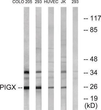 Anti-PIGX antibody produced in rabbit affinity isolated antibody