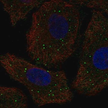 Anti-GALNT9 antibody produced in rabbit Prestige Antibodies&#174; Powered by Atlas Antibodies, affinity isolated antibody