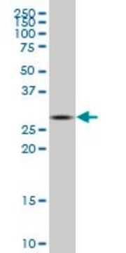 ANTI-CA1 antibody produced in mouse clone 10E4, purified immunoglobulin, buffered aqueous solution