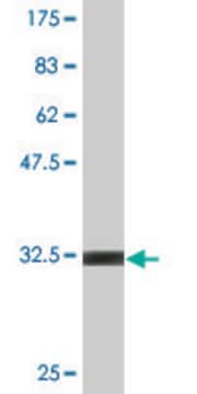 Monoclonal Anti-CHFR antibody produced in mouse clone 2B11, purified immunoglobulin, buffered aqueous solution