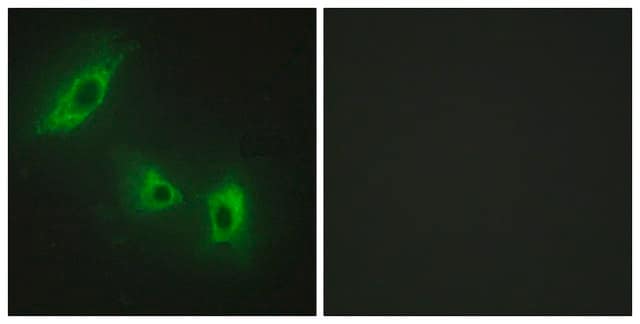 Anti-ACV1B antibody produced in rabbit affinity isolated antibody