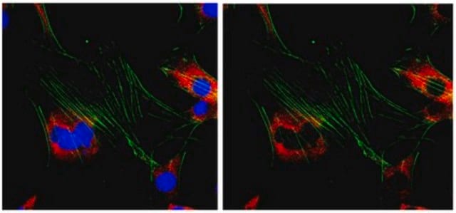 Anti-Ena/VASP-like protein Antibody from rabbit, purified by affinity chromatography