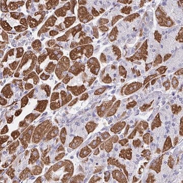 Anti-DTX3 antibody produced in rabbit Prestige Antibodies&#174; Powered by Atlas Antibodies, affinity isolated antibody, buffered aqueous glycerol solution