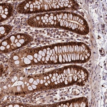 Anti-C16orf70 antibody produced in rabbit Prestige Antibodies&#174; Powered by Atlas Antibodies, affinity isolated antibody, buffered aqueous glycerol solution