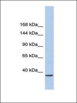 Anti-SMARCAD1 (AB2) antibody produced in rabbit affinity isolated antibody