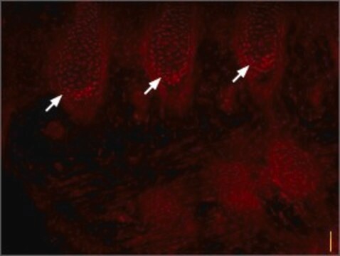 Anti-Sodium Channel, Brain Type III antibody produced in rabbit affinity isolated antibody, lyophilized powder