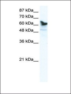 Anti-DDX41 antibody produced in rabbit IgG fraction of antiserum