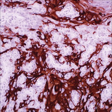 Cytokeratin 10 (EP97) Rabbit Monoclonal Primary Antibody