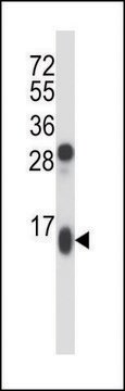 ANTI-GUCA2A (CENTER) antibody produced in rabbit IgG fraction of antiserum, buffered aqueous solution