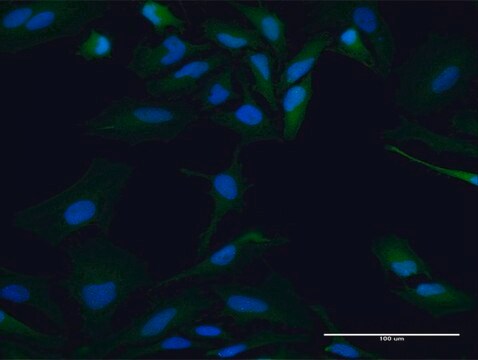 Anti-PBK antibody produced in mouse purified immunoglobulin, buffered aqueous solution