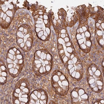 Anti-RBSN antibody produced in rabbit Prestige Antibodies&#174; Powered by Atlas Antibodies, affinity isolated antibody, buffered aqueous glycerol solution