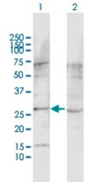 Anti-LPHN1 antibody produced in rabbit purified immunoglobulin, buffered aqueous solution