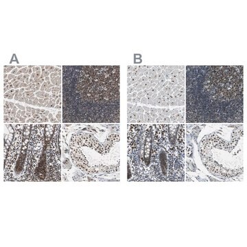 Anti-USP28 antibody produced in rabbit Ab2, Prestige Antibodies&#174; Powered by Atlas Antibodies, affinity isolated antibody, buffered aqueous glycerol solution