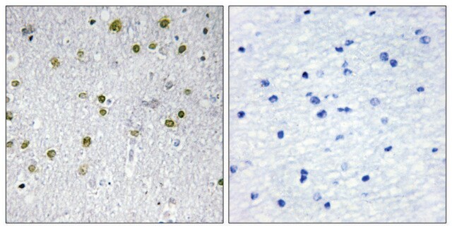 Anti-NRIP2 antibody produced in rabbit affinity isolated antibody