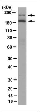 Anti-DOT1L Antibody, clone 1A11.2 clone 1A11.2, from mouse