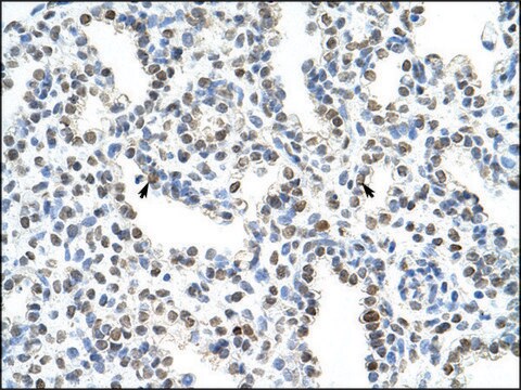 Anti-WDR6 antibody produced in rabbit affinity isolated antibody