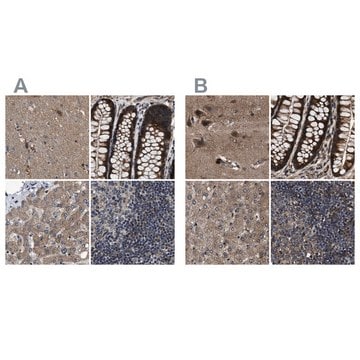 Anti-PPWD1 antibody produced in rabbit Prestige Antibodies&#174; Powered by Atlas Antibodies, affinity isolated antibody, buffered aqueous glycerol solution, Ab2